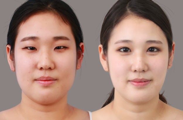 cosmetic surgery malaysia